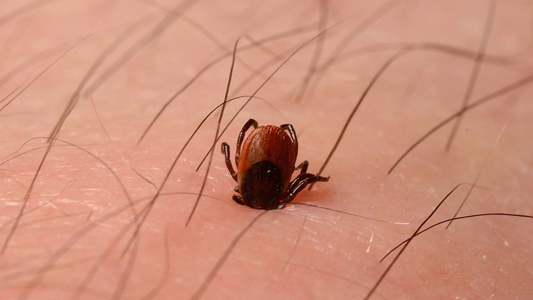 Febre Maculosa SP: Autoridades de Saúde Alertam para Riscos da Doença