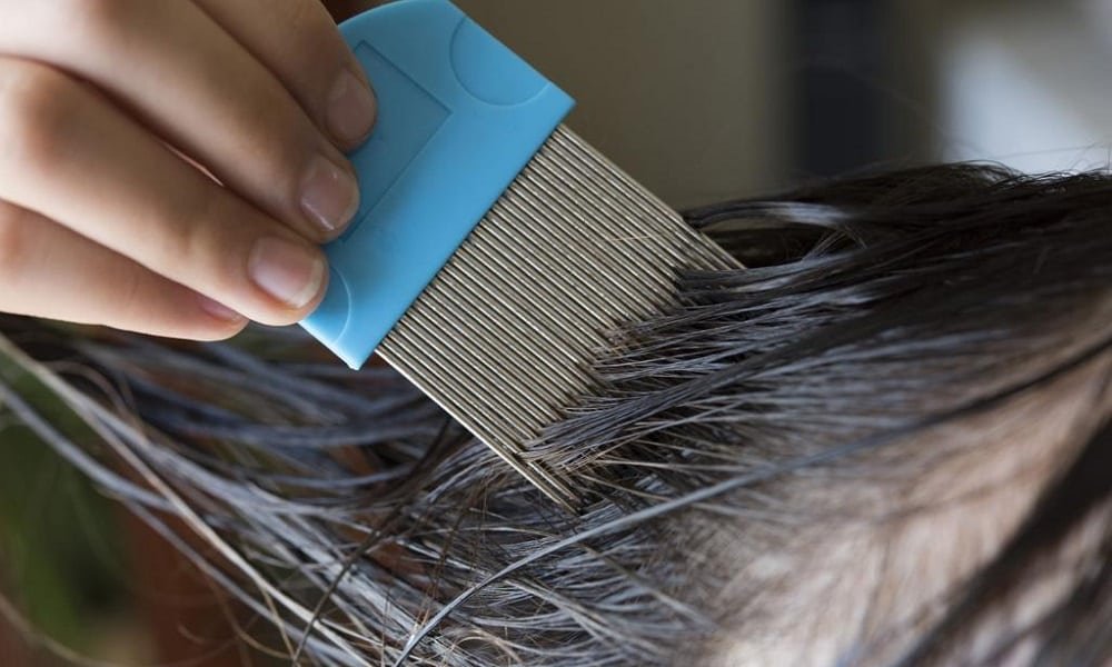 Melhores Remédios Caseiros para Acabar com Piolhos